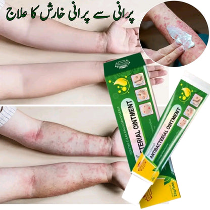 Psoriasis, Fungal & Eczema Care Cream – Skin Relief Formula