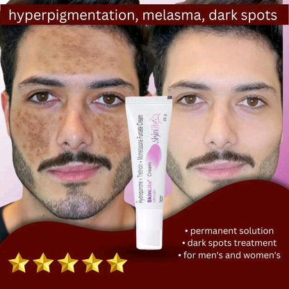 Whitening Cream for Melasma, Hyperpigmentation & Dark Spots | Brightening Skin Care