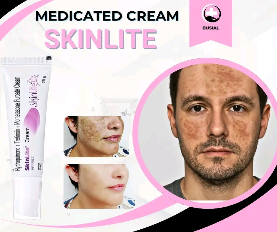 Whitening Cream for Melasma, Hyperpigmentation & Dark Spots | Brightening Skin Care