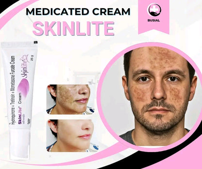 Whitening Cream for Melasma, Hyperpigmentation & Dark Spots | Brightening Skin Care