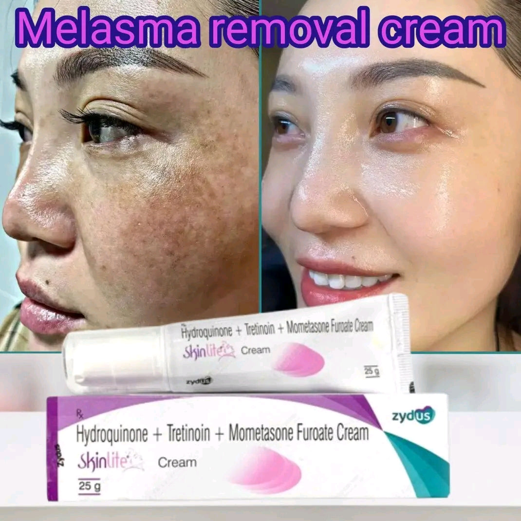 Whitening Cream for Melasma, Hyperpigmentation & Dark Spots | Brightening Skin Care
