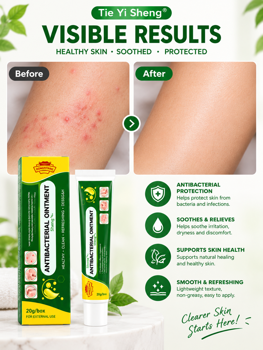 Tie Yi Sheng® Antibacterial Ointment – 20g