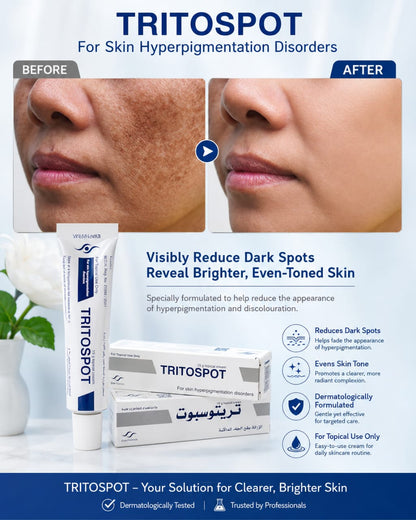 Whitening Cream for Melasma, Hyperpigmentation & Dark Spots Treatment